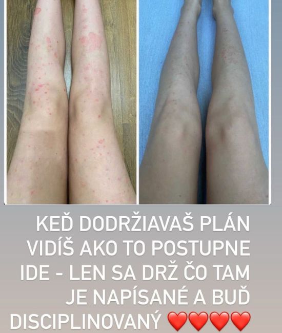 Obrázok 108
