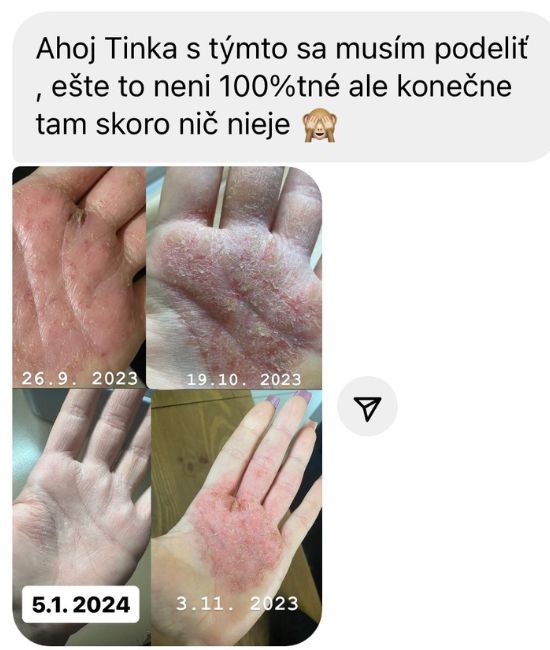Obrázok 110