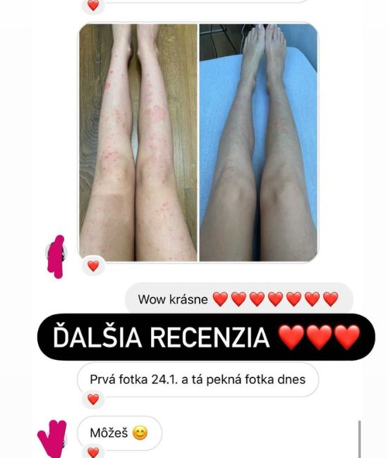 Obrázok 51