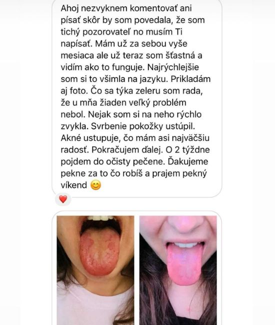 Obrázok 52