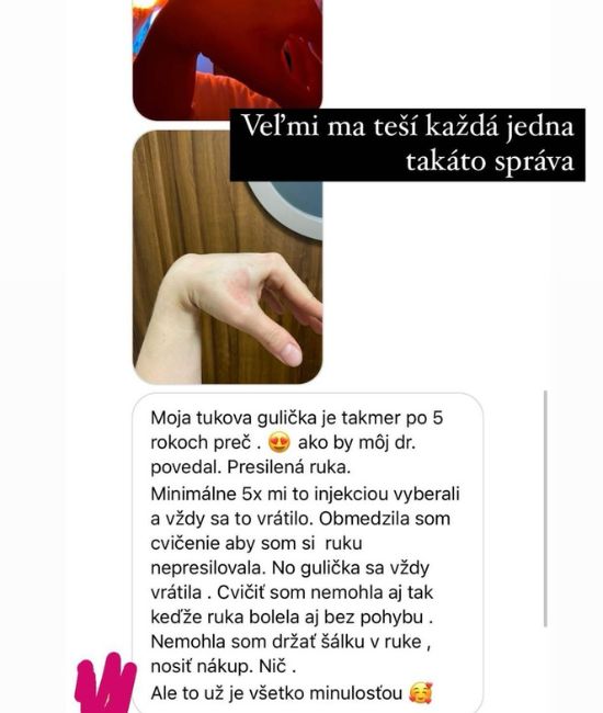 Obrázok 54